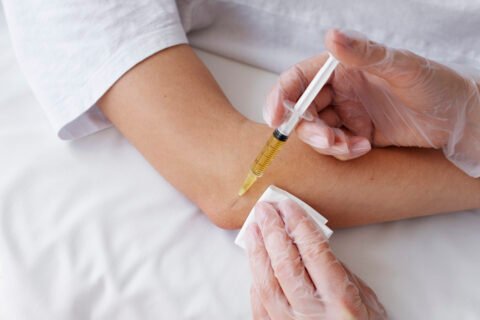 Corticosteroid Injections